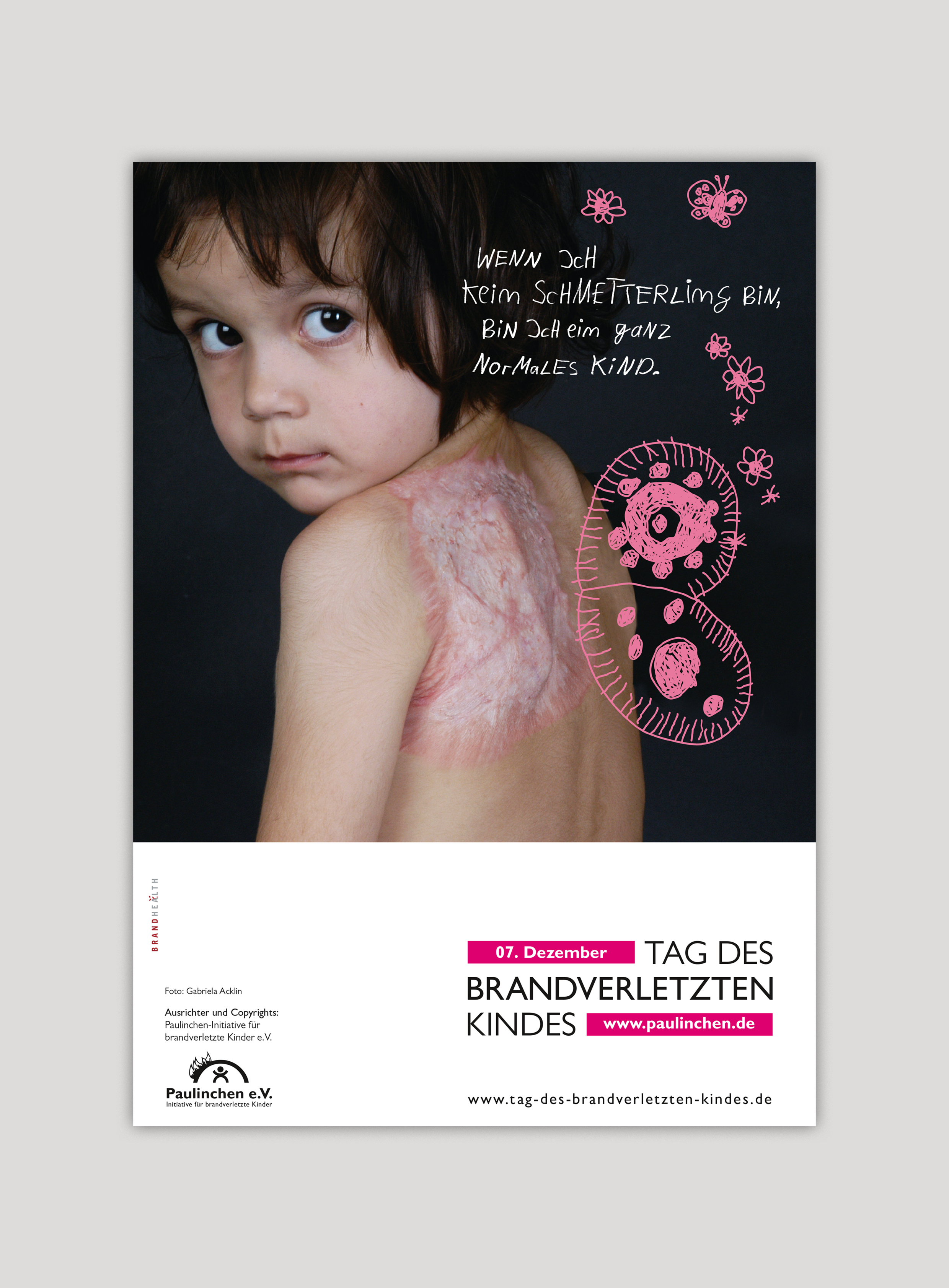 Tag des brandverletzten Kindes Poster